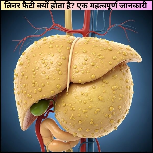 लिवर फैटी क्यों होता है? एक महत्वपूर्ण जानकारी