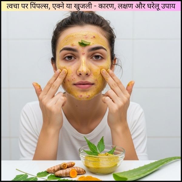 त्वचा पर पिंपल्स, एक्ने या खुजली : कारण, लक्षण और घरेलू उपाय